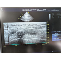 GE Vivid 7 Dimension 4D Cardiac Ultrasound Imaging System w/ M4S, 10S Probes
