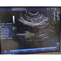 GE Logiq P5/A5 Ultrasound System HDD, Software + Opts & Restore Discs -Warranty-