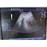 GE Logiq P5/A5 Ultrasound System HDD, Software + Opts & Restore Discs -Warranty-
