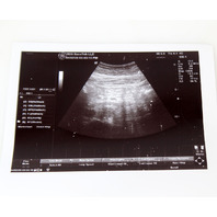 GE Logiq P5/A5 Ultrasound System HDD, Software + Opts & Restore Discs -Warranty-