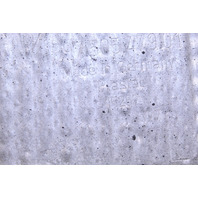 2009-2012 Porsche 911 997 Rear Bumper Bracket Heat Shield Left Driver - 99750563102 OEM