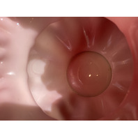 BEAUTIFUL VTG FENTON Pink/White Silver Crest Ruffled Rim Glass Melon Vase 5.5"H